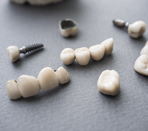 Bloomfield The Difference Between Dental Implants and Mini Dental Implants