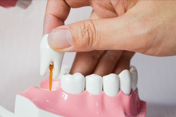 When Is Wisdom Tooth Extraction Necessary?